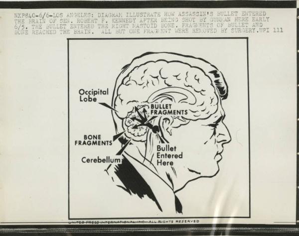 Los Angeles - Omicidio di Robert Kennedy - Disegno che illustra il percorso del proiettile