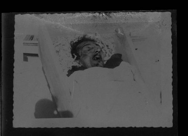 Seconda guerra mondiale - Cadavere in una cassa - Volto maschile