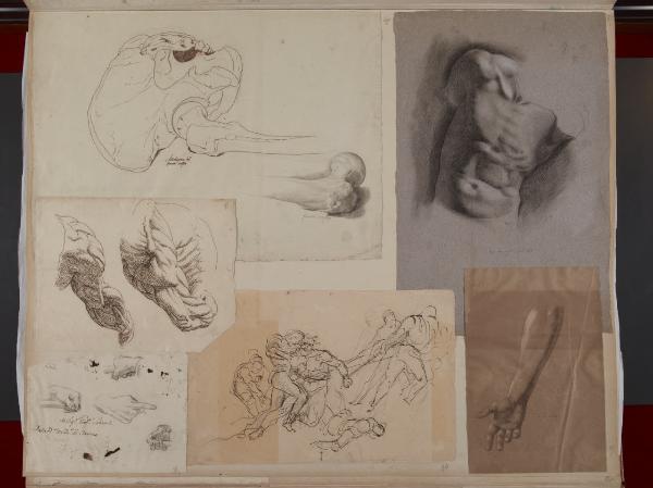 Articolazione del bacino e femore sinistro