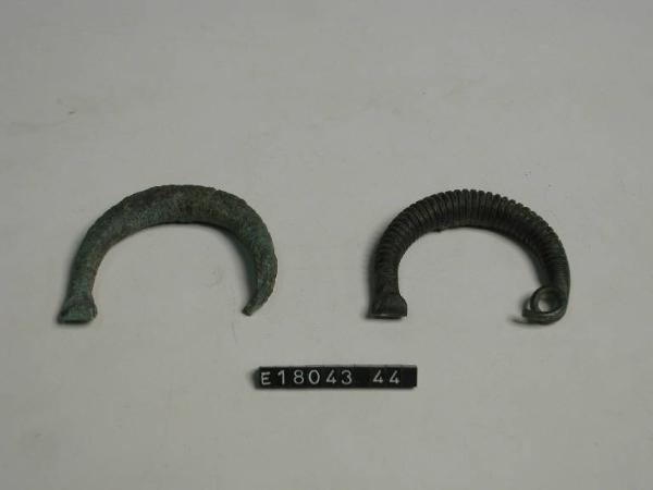 Fibula ad arco ingrossato